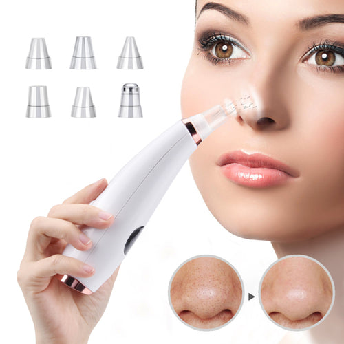 Aspirateur Facial Anti-Points Noirs — Nettoyage en Profondeur 5-en-1